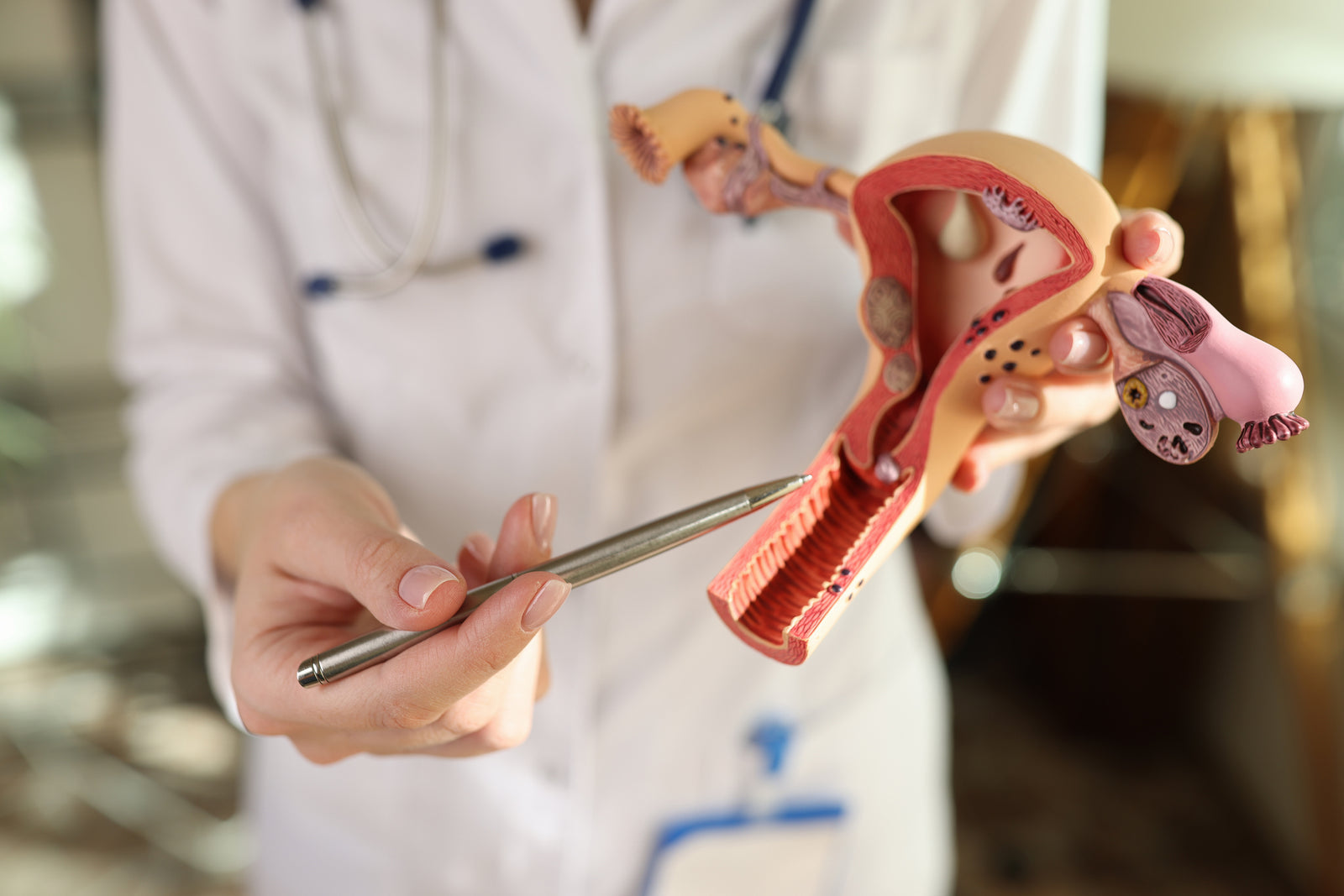 A doctor points to the cervix on a female pelvic model.