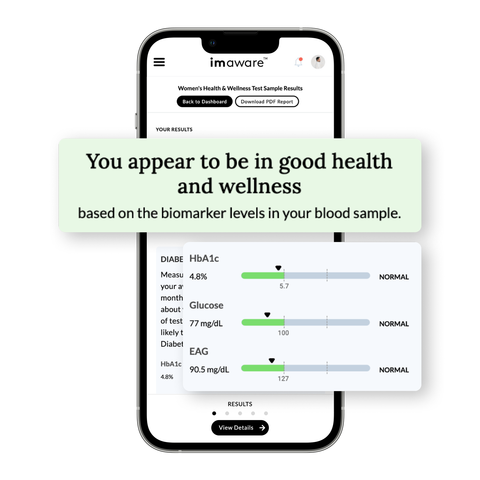 AtHome Vitamin D Monitoring Kit Because Market