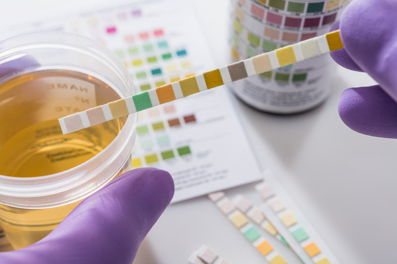 A lab technician tests urine.