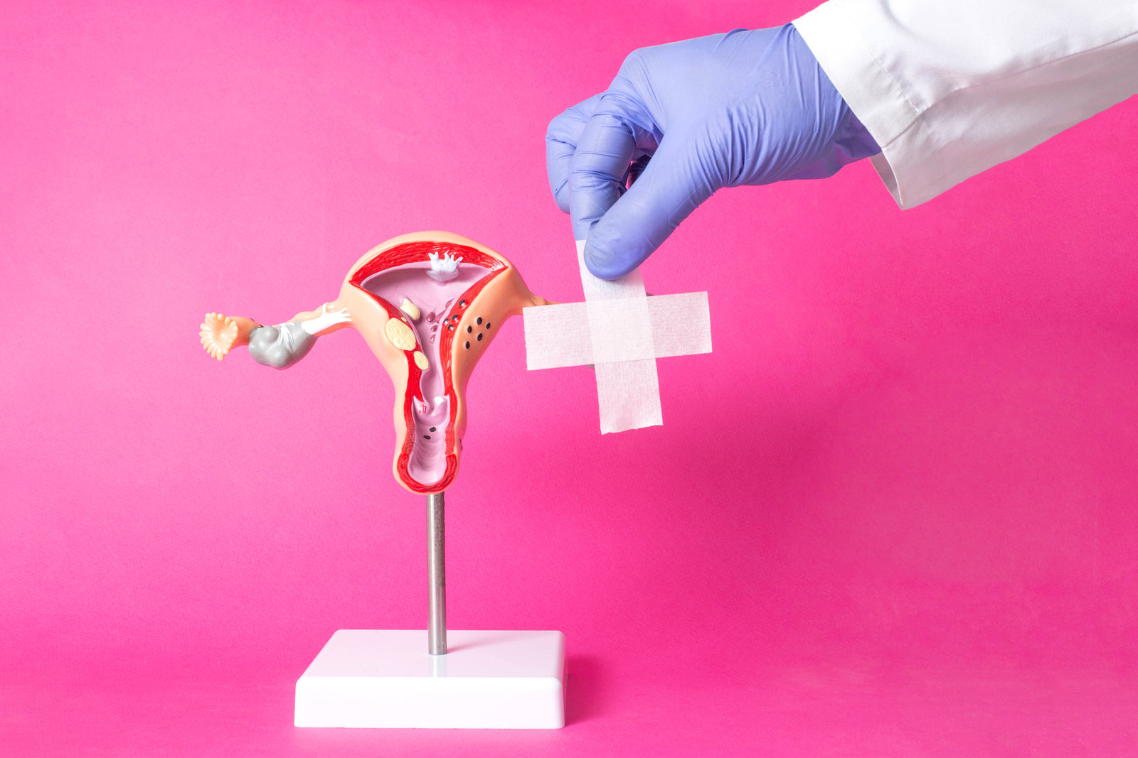 A bandaid on a model of a uterus.