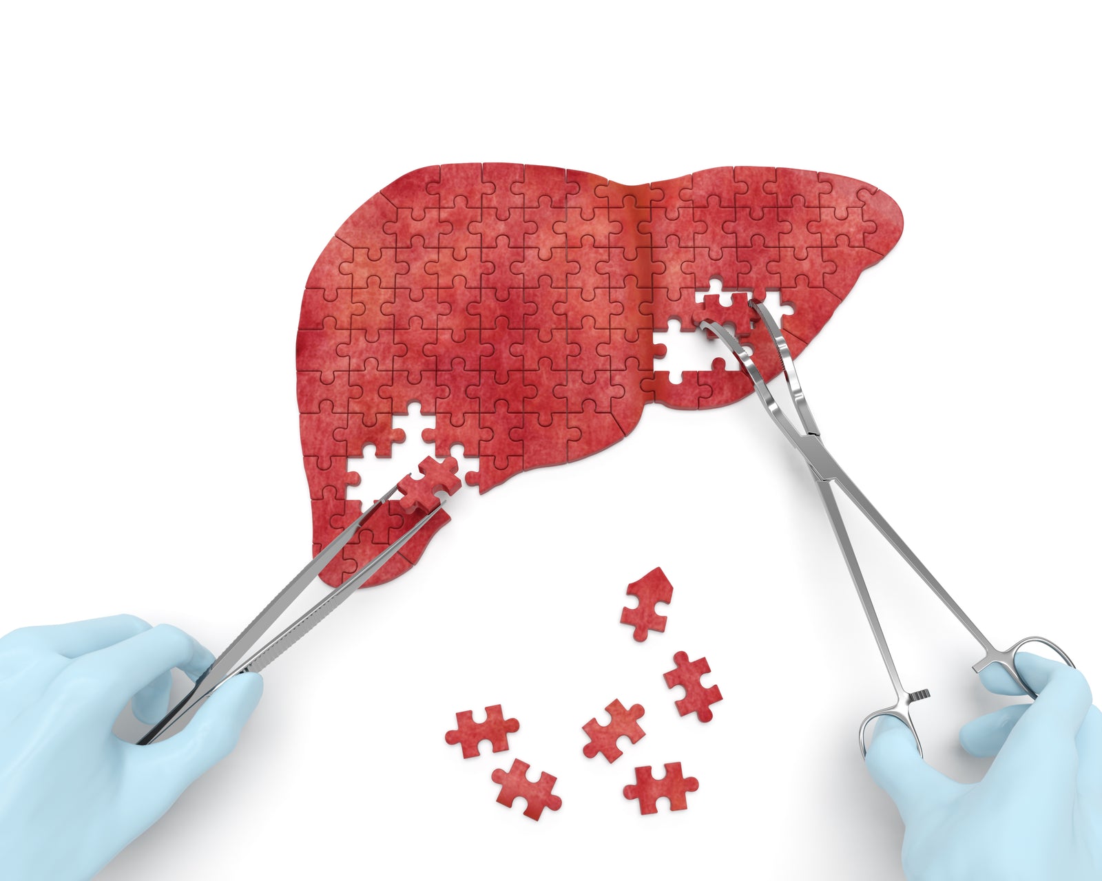 A puzzle piece liver 