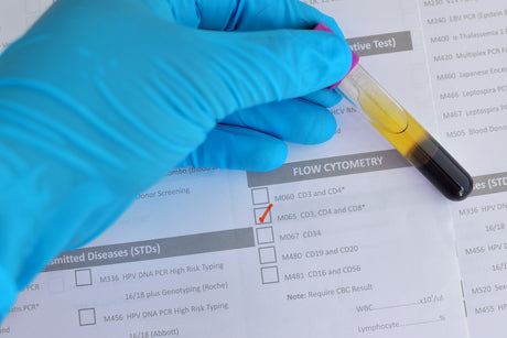 A gloved hand holds a test tube with a urine sample