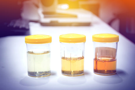 Three cups of urine of different concentrates.